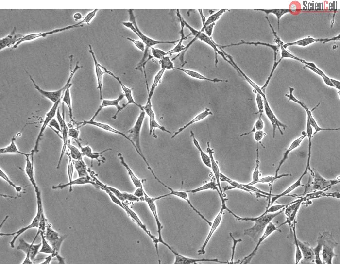 Rat Schwann Cells (RSC) - Phase contrast, 200x.
