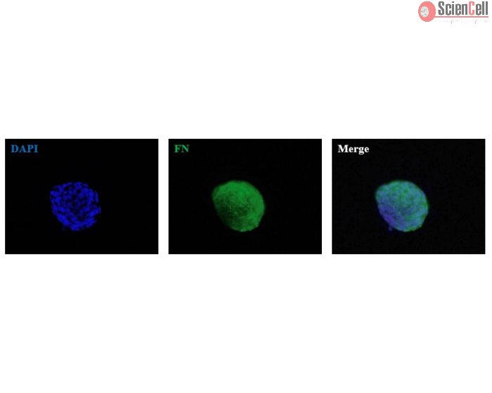 Human Bronchial Fibroblast Spheroids express the fibroblast marker fibronectin (FN). 