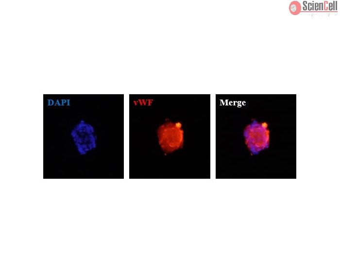 Human Hepatic Sinusoidal Endothelial Cell Spheroids express the endothelial cell marker von Willebrand factor (vWF). 