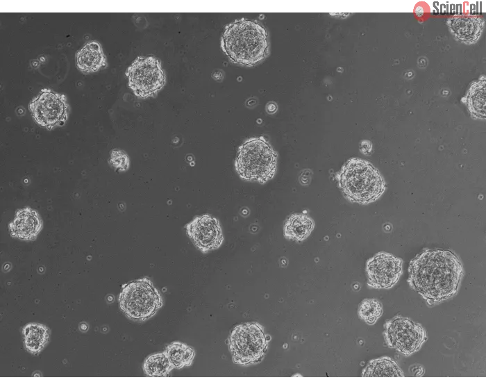 At 24 h post thawing - Osteoblast and endothelial cells co-culture spheroids.
