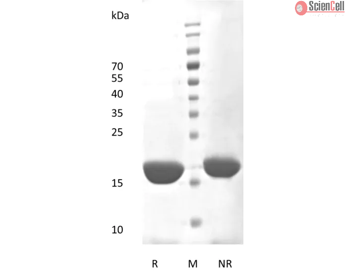 Recombinant Human Interleukin-6