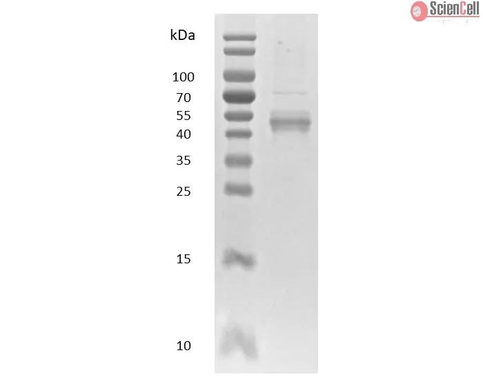 Recombinant Human NFkB