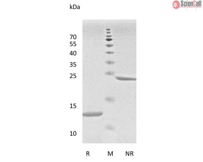 Recombinant Human Transforming Growth Factor-β1 