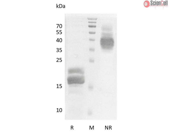 Recombinant Human Vascular Endothelial Growth Factor B