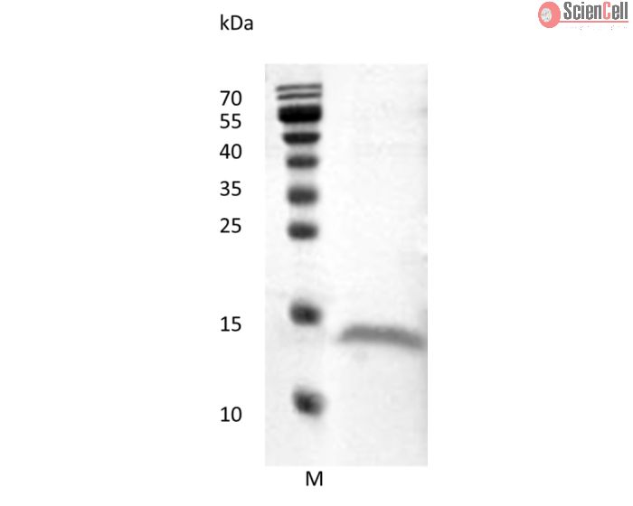 Recombinant Human Vascular Endothelial Growth Factor D