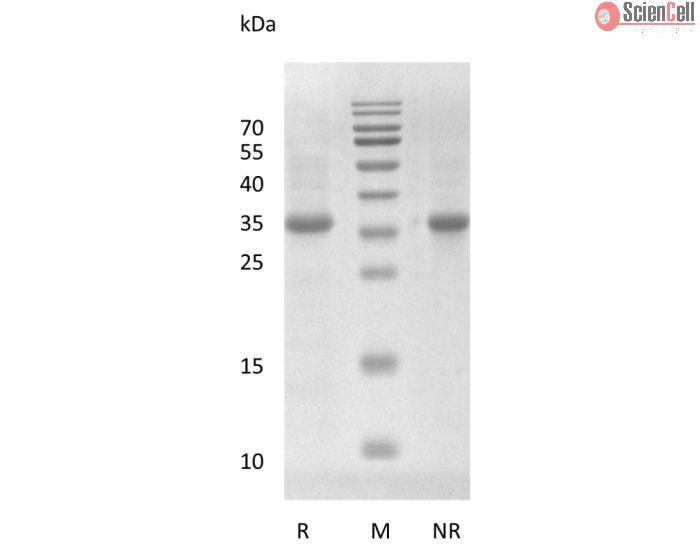 Recombinant Human Wnt-3a Protein, E. coli Derived