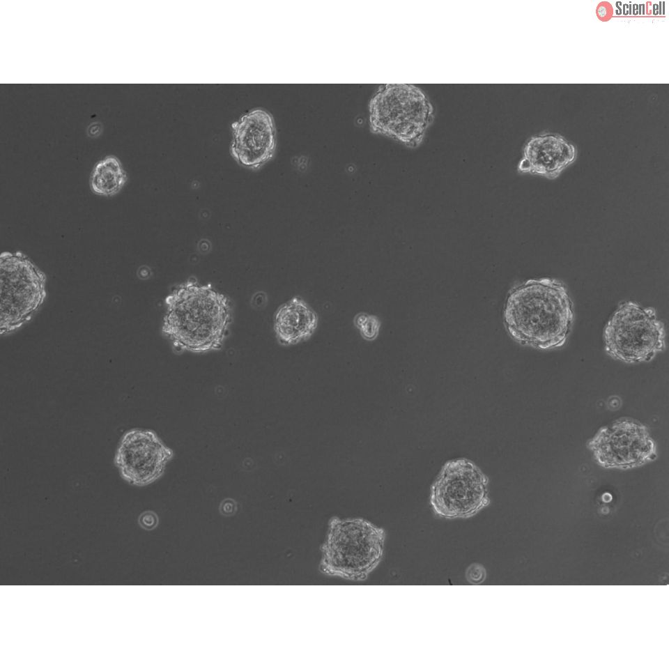 All-inclusive 3D Human Hepatic Stellate Cell Monoculture Spheroid...