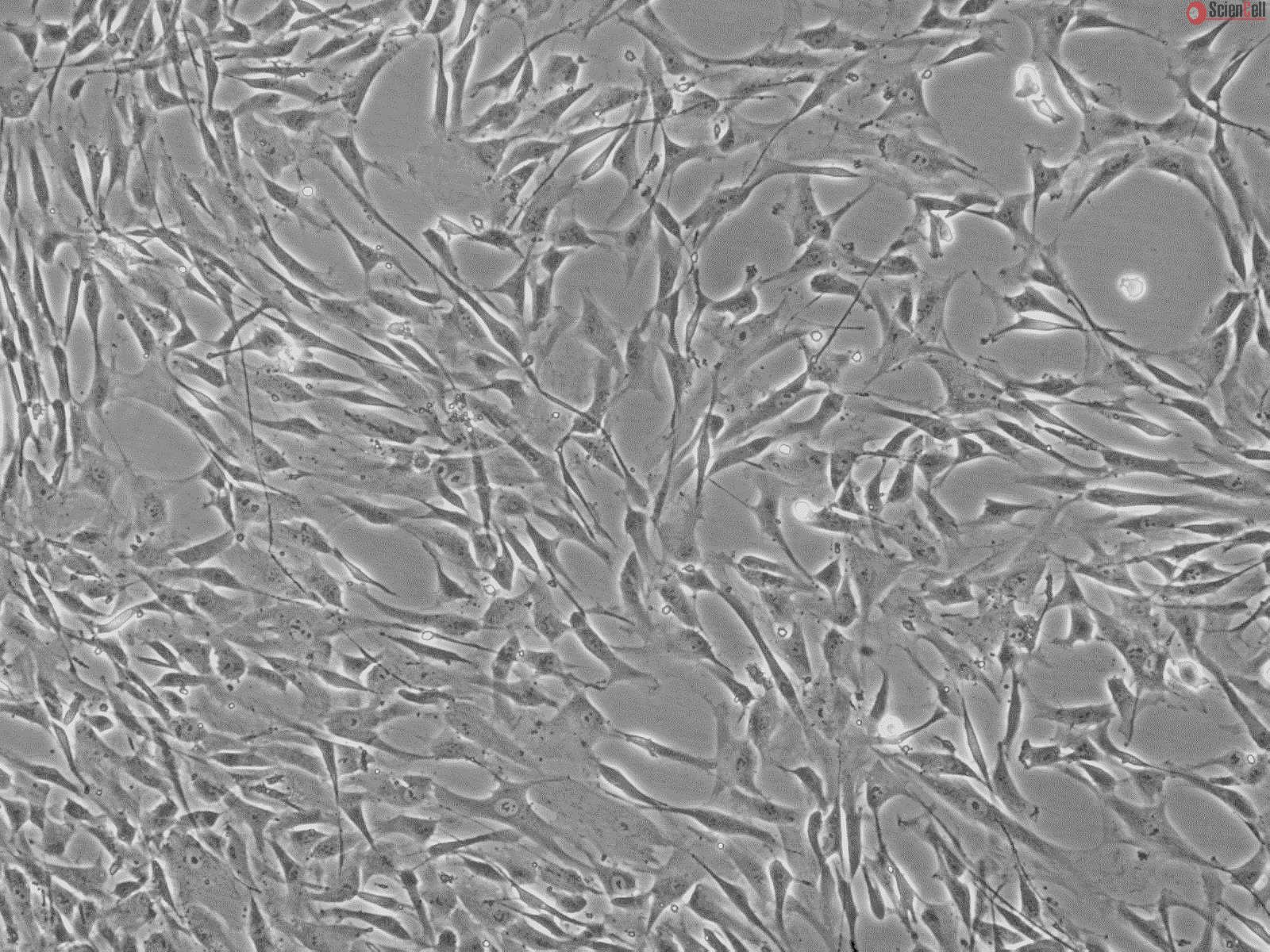 Human Aortic Adventitial Fibroblasts (HAAF) | ScienCell Research ...