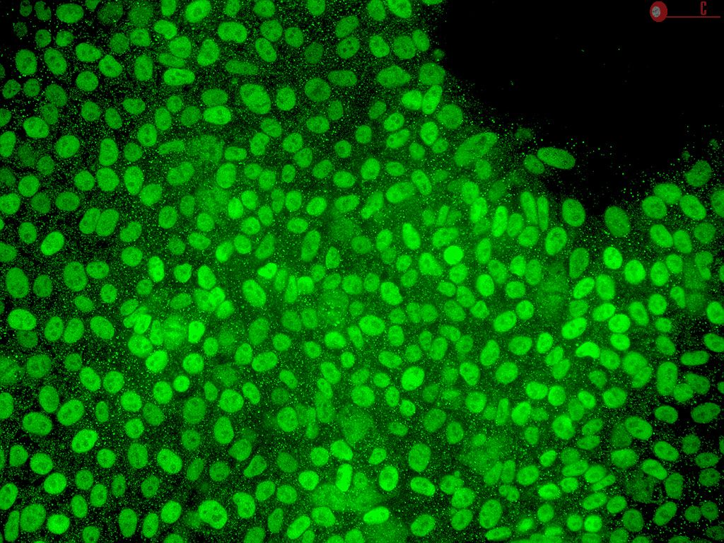 Stemium, Human Pluripotent Stem Cell Growth Medium (STEMium)