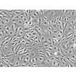 人冠状动脉内皮细胞 (HCAEC) - 相位对比，200倍。