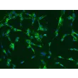 人口腔成纤维细胞（HOrF）- 纤连蛋白（Fibronectin）免疫染色，200×
