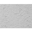 人口腔成纤维细胞（HOrF）- 浮雕相差显微镜，200×
