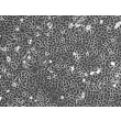 人小气道上皮细胞（成人）（HSAEpiC-a）- 相差显微镜，100×