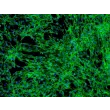 人扁桃体成纤维细胞（HTF）- 纤连蛋白免疫染色，100×

