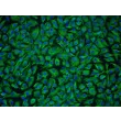人椎间盘髓核细胞（HNPC）- 波形蛋白免疫染色，200倍。