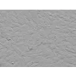 人椎体间充质干细胞（HVMSC）- 浮雕相差，200×

