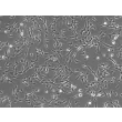 人气管成纤维细胞（HTrF）- 相差显微镜，100×

