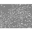 人源中耳上皮细胞（HMEEpiC）- 凸显衬度显微图像，200×