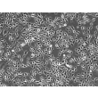 人源中耳上皮细胞（HMEEpiC）- 相差显微图像，100×