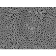 人源子宫内膜微血管内皮细胞（HEMEC）- 相差显微镜，200×