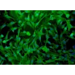 人源子宫肌层平滑肌细胞（HMSMC）- α-SMA 免疫染色，200×
