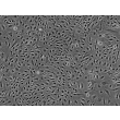 人源子宫肌层微血管内皮细胞（HMMEC）- 相差显微镜，200×