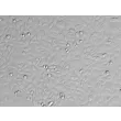 人源宫颈上皮细胞（HCerEpiC）- 凸显衬度，200×

