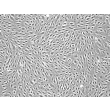 人源宫颈微血管内皮细胞（HCerMEC）- 相差显微镜，100×
