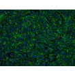 人源宫颈微血管内皮细胞（HCerMEC）- vWF 免疫染色，200×

