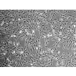 人源甲状腺成纤维细胞（HThF）- 相差显微镜，100×
