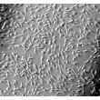人源甲状腺成纤维细胞（HThF）- 凸显衬度，100×

