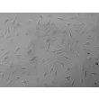 人源胎儿心房源心脏成纤维细胞（HCF-fa）- 凸显衬度，200×
