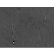 人源胸腺成纤维细胞（HTyF）- 凸显衬度，400×
