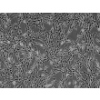 人源胸腺成纤维细胞（HTyF）- 相差显微镜，100×
