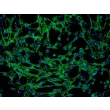 人源胸腺成纤维细胞（HTyF）- 纤连蛋白免疫染色，200×
