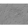 人源表皮黑色素细胞（中等色素型，HEM-m）- 凸显衬度，400×
