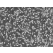 人源表皮黑色素细胞（中等色素型，HEM-m）- 相差显微镜，100×
