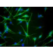 人源表皮黑色素细胞（中等色素型，HEM-m）- S100-β 免疫染色，400×