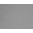 人直肠成纤维细胞（HRecF）- 浮雕相差显微镜图像，200×
