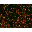人直肠成纤维细胞（HRecF）- 纤连蛋白（Fibronectin）免疫荧光染色，200×
