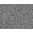 人体皮肤成纤维细胞-新生儿 (HDF-n) - 相差显微镜，100x.