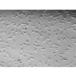 人体皮肤成纤维细胞-新生儿 (HDF-n) - 凸显显微镜，200x.