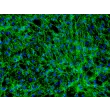 人体皮肤成纤维细胞-新生儿 (HDF-n) - 纤连蛋白免疫染色，200x.