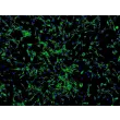 人眼脉络膜成纤维细胞（HOCF）- 纤连蛋白（Fibronectin）免疫染色，100×