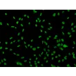 人睾丸支持细胞（HSerC）- SOX-9 免疫染色，200×