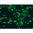 人睾丸间质细胞（HLC）- CK-18 免疫染色，200×
