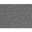 人硬脑膜微血管内皮细胞（HDuMEC）- 浮雕相差显微镜，200×