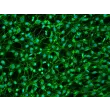 人硬脑膜成纤维细胞（HDuF）- 纤连蛋白（FN）免疫染色，200×