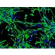 人类星形胶质细胞-脑干（HA-bs）- GFAP免疫染色，100倍放大。