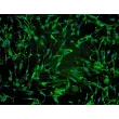 人类毛发真皮乳头细胞（HHDPC）- 纤维连接蛋白免疫染色，100倍。